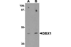 Western blot analysis of DBX1 in mouse kidney tissue lysate with DBX1 antibody at (A) 1 and (B) 2 µg/mL. (DBX1 抗体  (Middle Region))