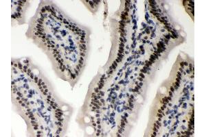 Anti- CSNK1A1 Picoband antibody,IHC(P) IHC(P): Mouse Intestine Tissue (CSNK1A1 抗体  (N-Term))