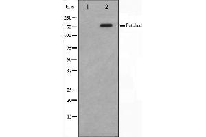 Western blot analysis of Patched expression in mouse muscle cells,The lane on the left is treated with the antigen-specific peptide. (Patched 1 抗体)