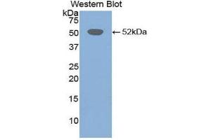 Western Blotting (WB) image for anti-Fibrinogen beta Chain (FGB) (AA 35-481) antibody (ABIN1858854) (Fibrinogen beta Chain 抗体  (AA 35-481))