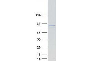 Western Blotting (WB) image for Annexin A11 (ANXA11) (Transcript Variant C) protein (Myc-DYKDDDDK Tag) (ABIN2714733)