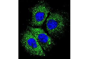 Confocal immunofluorescent analysis of CYBA Antibody (C-term) (ABIN656083 and ABIN2845428) with NCI- cell followed by Alexa Fluor 488-conjugated goat anti-rabbit lgG (green). (CYBA 抗体  (C-Term))
