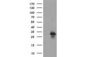 Western Blotting (WB) image for anti-RASD Family, Member 2 (RASD2) antibody (ABIN1500697) (RASD2 抗体)