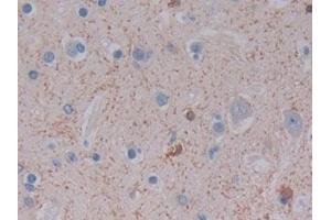 Immunohistochemistry (IHC) image for anti-Ferritin, Light Polypeptide (FTL) (AA 2-175) antibody (ABIN7435310)