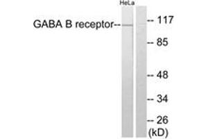 Western blot analysis of extracts from HeLa cells, using GABA-B Receptor Antibody. (GABBR1 抗体  (AA 871-920))