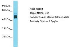 Image no. 1 for anti-Desert Hedgehog (DHH) (AA 74-123) antibody (ABIN6750459) (desert Hedgehog 抗体  (AA 74-123))