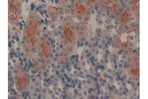 Detection of GAL9 in Mouse Kidney Tissue using Polyclonal Antibody to Galectin 9 (GAL9) (Galectin 9 抗体  (AA 225-353))