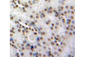 Used in DAB staining on fromalin fixed paraffin-embedded Kidney tissue (NMES1 抗体  (AA 1-83))