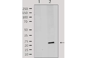 Western Blotting (WB) image for anti-Mitochondrial Ribosomal Protein L20 (MRPL20) (C-Term) antibody (ABIN6258515)