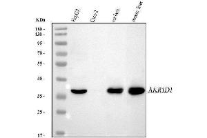 Western blot analysis of AKR1D1 using anti-AKR1D1 antibody (ABIN6719640).