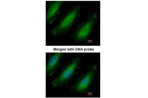 ICC/IF Image Immunofluorescence analysis of paraformaldehyde-fixed HeLa, using RPL13A, antibody at 1:200 dilution. (RPL13A 抗体)