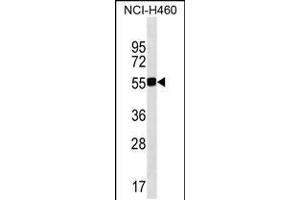 Western blot analysis in NCI-H460 cell line lysates (35ug/lane). (QRSL1 抗体  (N-Term))