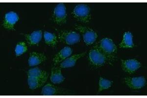 IF analysis of CAD using anti-CAD antibody (ABIN7600044).