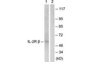 Western blot analysis of extracts from HepG2 cells, using IL-2R beta (Ab-364) Antibody. (IL2 Receptor beta 抗体  (AA 331-380))