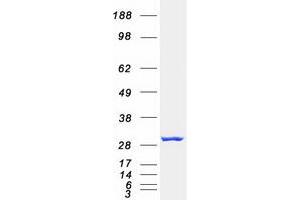 Western Blotting (WB) image for Proteasome Subunit alpha  7 (PSMA7) protein (Myc-DYKDDDDK Tag) (ABIN2729923)