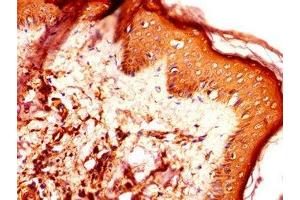 Immunohistochemistry of paraffin-embedded human skin tissue using ABIN7166807 at dilution of 1:100