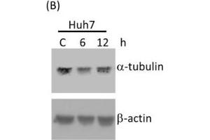Western Blotting (WB) image for anti-Tubulin, alpha 1B (TUBA1B) antibody (ABIN2855283)