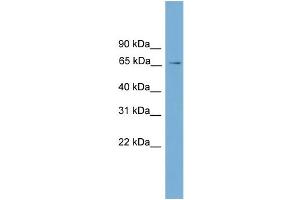 WB Suggested Anti-L3mbtl Antibody Titration:  0. (L3MBTL1 抗体  (Middle Region))