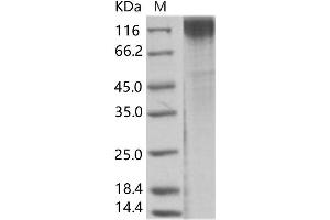 Simian Immunodeficiency Virus Surface Glycoprotein (SIV gp120) protein (His tag)