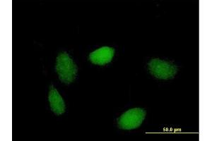 Immunofluorescence of purified MaxPab antibody to LSM1 on HeLa cell. (LSM1 抗体  (AA 1-133))