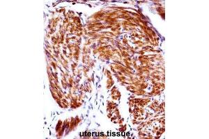 Immunohistochemistry (IHC) image for anti-Progestagen-Associated Endometrial Protein (PAEP) antibody (ABIN2998090) (PAEP 抗体)