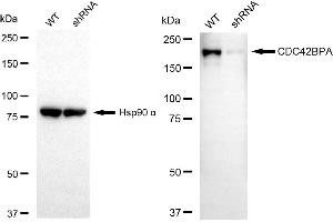 Western blotting analysis using CDC42BPA antibody (ABIN7797991).