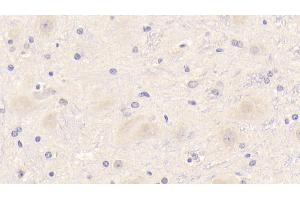 Detection of TREM2 in Mouse Cerebrum Tissue using Polyclonal Antibody to Triggering Receptor Expressed On Myeloid Cells 2 (TREM2) (TREM2 抗体  (AA 1-227))
