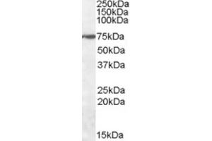 Western Blotting (WB) image for anti-Zinc Finger Protein 803 (ZNF803) (Internal Region) antibody (ABIN2464204) (WIZ 抗体  (Internal Region))