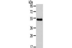 Western Blot analysis of Human placenta tissue using NR2F2 Polyclonal Antibody at dilution of 1/200 (NR2F2 抗体)