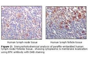 Image no. 1 for anti-Bruton Agammaglobulinemia tyrosine Kinase (BTK) antibody (ABIN232137) (BTK 抗体)