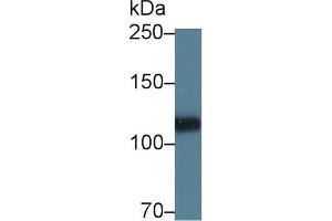 Western blot analysis of Pig Heart lysate, using Human HSPG2 Antibody (5 µg/ml) and HRP-conjugated Goat Anti-Rabbit antibody (