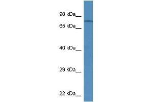 Western Blot showing Trpv6 antibody used at a concentration of 1. (TRPV6 抗体  (Middle Region))
