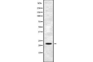 Western blot analysis FGF6 using HuvEc whole cell lysates (FGF6 抗体  (N-Term))
