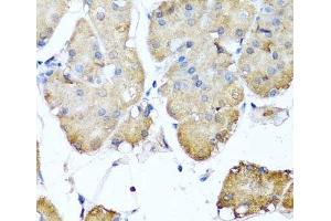 Immunohistochemistry of paraffin-embedded Human stomach using NIN Polyclonal Antibody at dilution of 1:100 (40x lens). (Ninein 抗体)