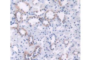Immunohistochemistry (IHC) image for anti-Rhotekin (RTKN) (AA 296-548) antibody (ABIN5014276)