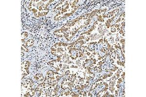 IHC analysis of TRIR using anti-TRIR antibody (ABIN7603244). (Uncharacterized Protein C19orf43 (TRIR) (N-Term) 抗体)