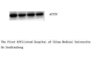 Western Blot (WB) analysis: Please contact us for more details. (beta Actin 抗体  (N-Term))