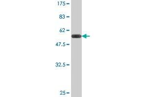 Western Blot detection against Immunogen (51. (TGIF2 抗体  (AA 1-237))
