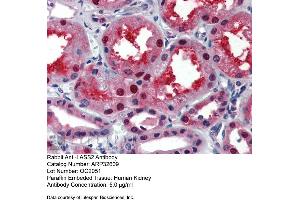 Immunohistochemistry with Human kidney lysate tissue at an antibody concentration of 5. (Ceramide Synthase 2 抗体  (N-Term))