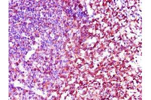 Immunohistochemistry of paraffin-embedded human tonsil tissue using ABIN7174038 at dilution of 1:100 (LCK 抗体  (AA 1-539))