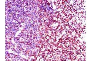 Immunohistochemistry of paraffin-embedded human tonsil tissue using ABIN7174038 at dilution of 1:100
