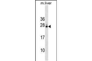 Western blot analysis in mouse liver tissue lysates (35ug/lane). (DNAJB9 抗体  (N-Term))