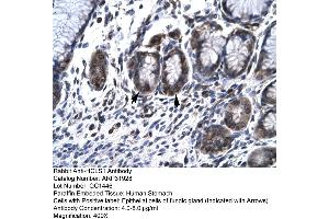 Rabbit Anti-HCLS1 Antibody  Paraffin Embedded Tissue: Human Stomach Cellular Data: Epithelial cells of Fundic Gland Antibody Concentration: 4. (HCLS1 抗体  (N-Term))