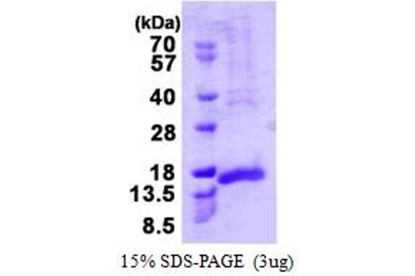 CENPH Protein (AA 136-247) (His tag)