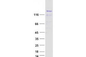 Western Blotting (WB) image for Transcription Elongation Factor SPT5 (SUPT5H) (Transcript Variant 2) protein (Myc-DYKDDDDK Tag) (ABIN2733009)