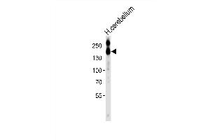 Western blot analysis of lysate from HT-1080 cell line, using NC Antibody (C-term) (ABIN6242237 and ABIN6577689). (CD56 抗体  (C-Term))