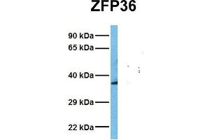 Host:  Rabbit  Target Name:  ZFP36  Sample Tissue:  Human Fetal Liver  Antibody Dilution:  1. (ZFP36 抗体  (N-Term))