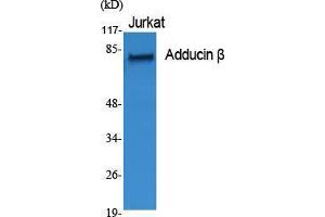 Western Blot (WB) analysis of specific cells using Adducin beta Polyclonal Antibody. (ADD2 抗体  (Internal Region))