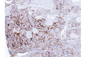 IHC-P Image Immunohistochemical analysis of paraffin-embedded SG xenograft, using alkaline phosphatase(intestinal), antibody at 1:100 dilution. (Intestinal Alkaline Phosphatase 抗体)