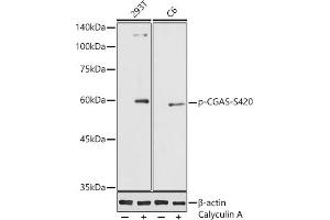 Western blot analysis of extracts of various cell lines, using Phospho-CGAS-S420 antibody (ABIN7266387) at 1:1000 dilution. (C6orf150 抗体  (pSer420))
